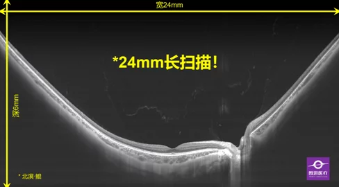 1024成线在人免费视频引发热议，网友纷纷讨论其对社会文化的影响与未来发展趋势